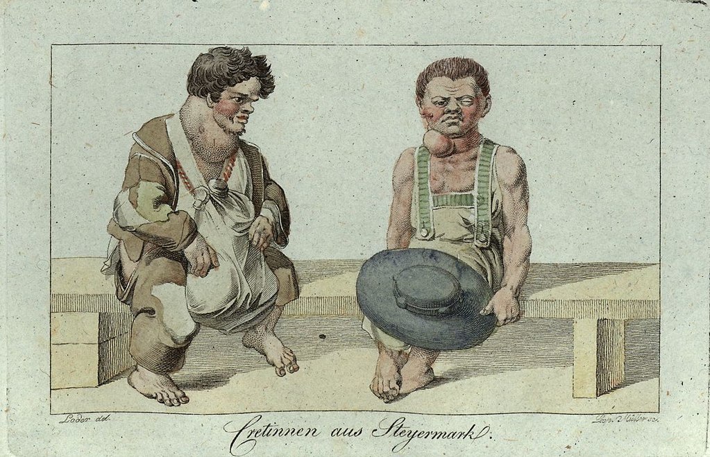 An illustration of cretinism from the 1800s, with an emphasis on goiter.